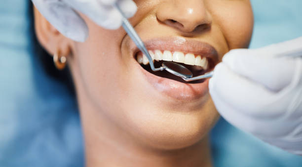 Best Emergency Broken Tooth Repair in Geneva, OH